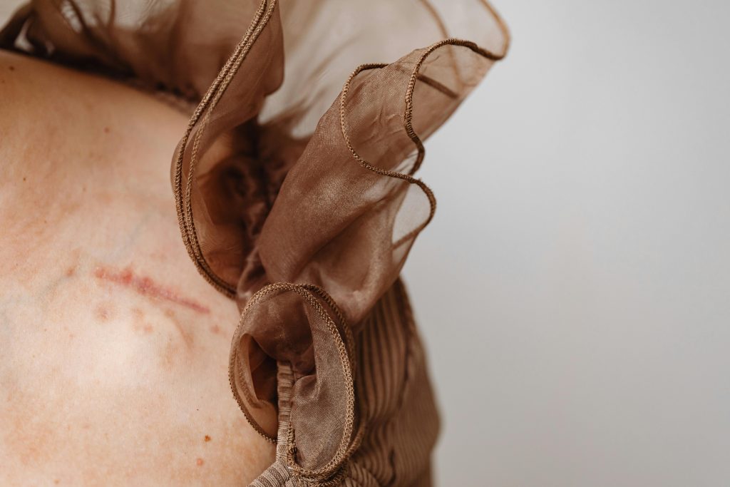 surgery-leaves-scars